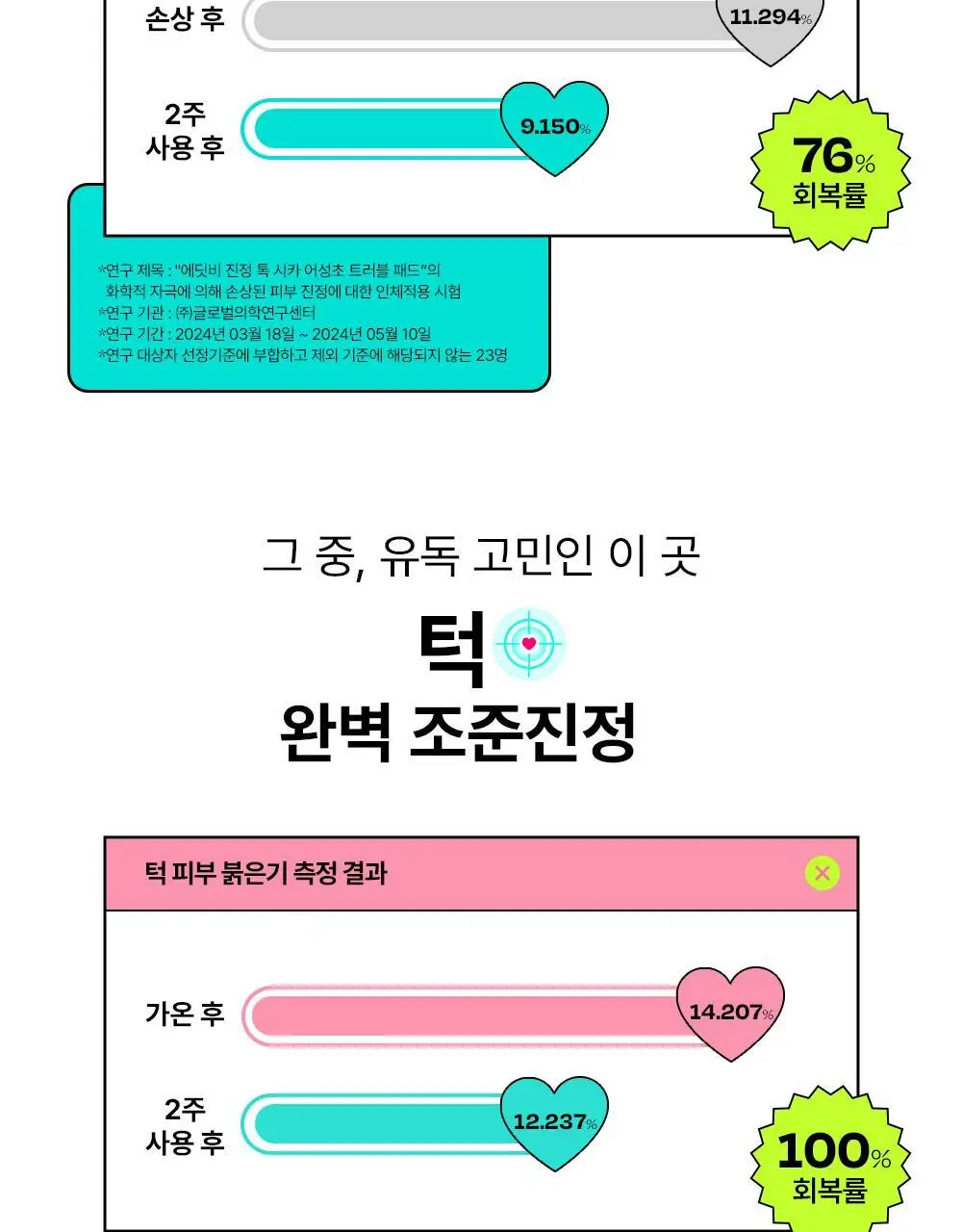 [쿨링진정/찢어쓰는패드] 에딧비 진정 톡 시카 어성초 트러블 패드 70매 상세페이지 29